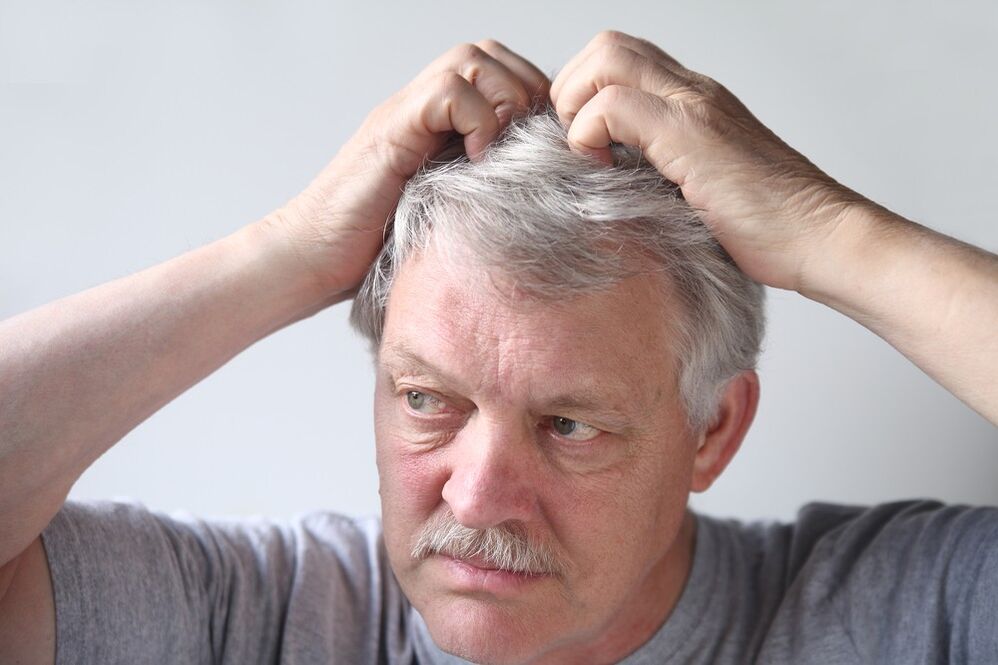 Psoriasis symptoms on the head