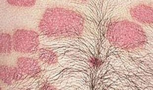 Several pink formations on the stomach