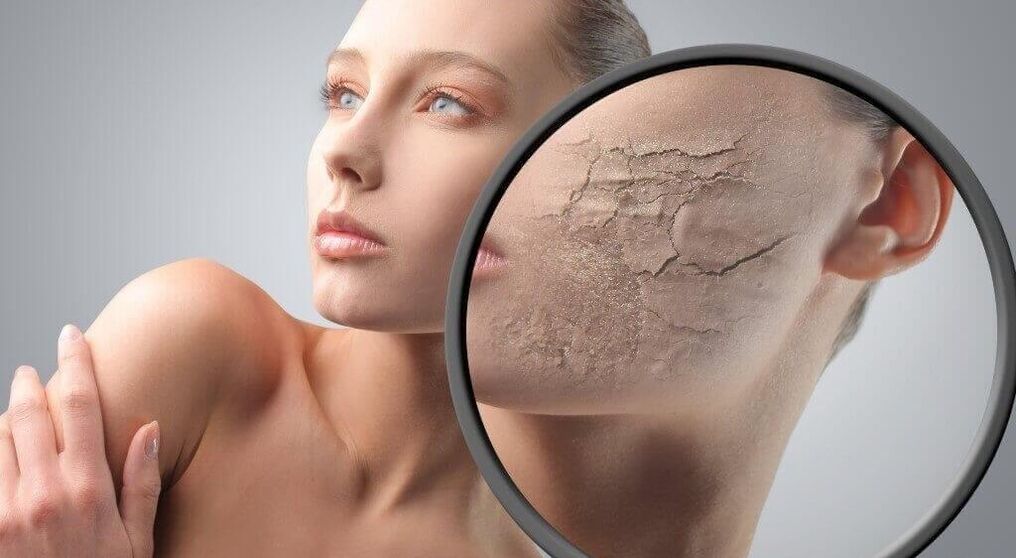 Destruction of the skin